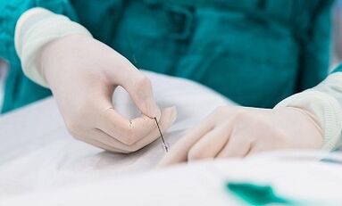 Diagnoza żylaków małej miednicy